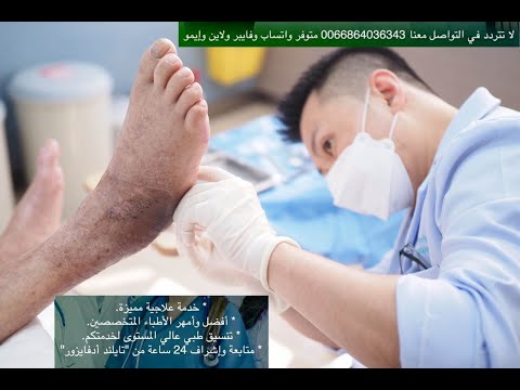 مركز علاج القدم السكري في مستشفى بياويت بانكوك - التقرحات، الجروح، تورمات (غرغرينا القدم السكري) 202