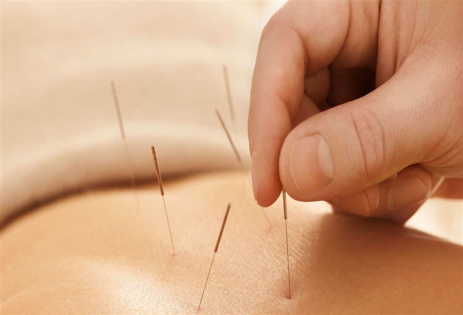 Chinese acupuncture in Thailand