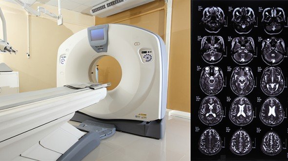 العلاج الإشعاعي للأورام بجهاز غاما نايف في تايلاند