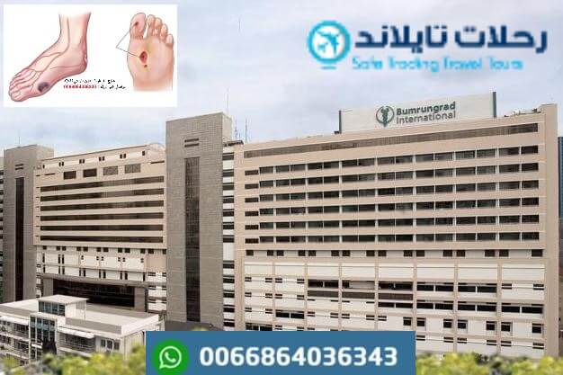 مركز علاج القدم السكري والجروح bumrungrad hospital thailand1